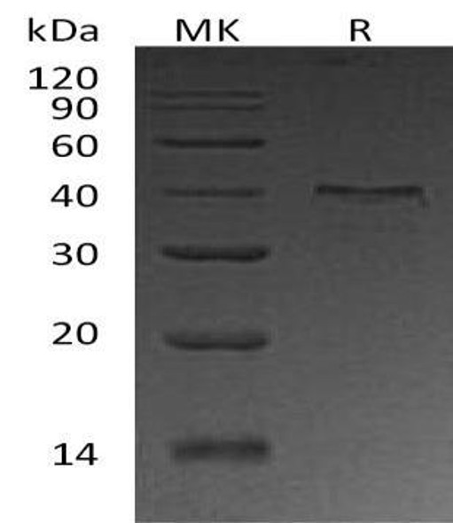 Human UPRT Recombinant Protein (RPES2272)