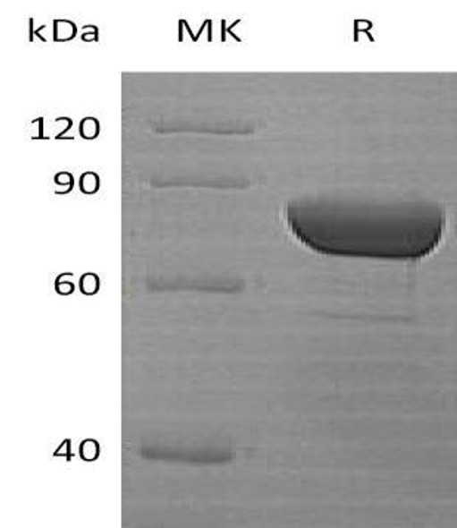 Human DPP3 Recombinant Protein (RPES2396)