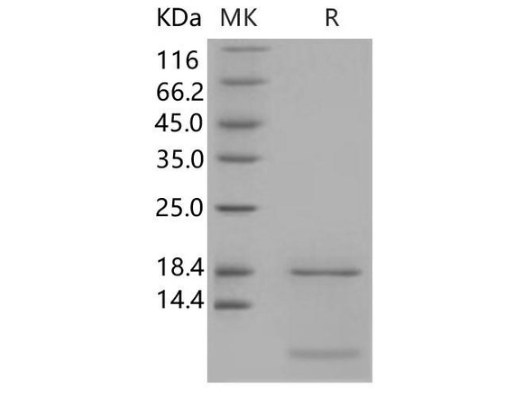 Human S100A6 Recombinant Protein (RPES2460)