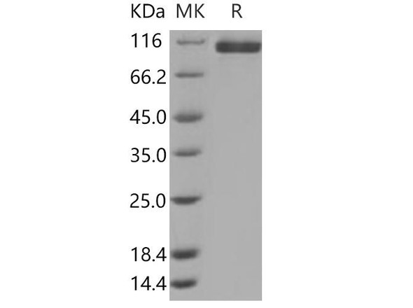 Human Neuropilin-2/NRP2 Recombinant Protein (His Tag) (Active) (RPES2512)