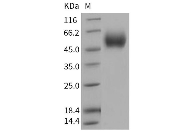 Human IL17RD Recombinant Protein (His Tag) (RPES2515)