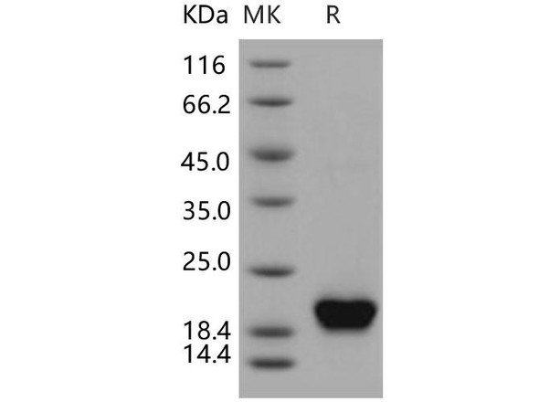 Human NUDT2/Ap4A hydrolase Recombinant Protein (His Tag) (RPES2533)