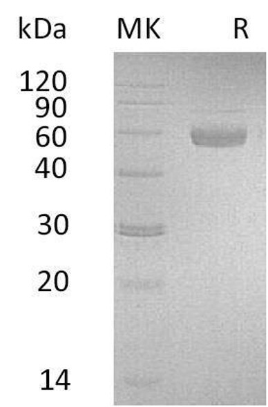 Human PSG3 Recombinant Protein (RPES2541)