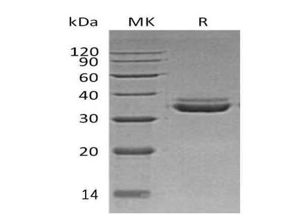 Human LMAN2L Recombinant Protein (RPES2542)