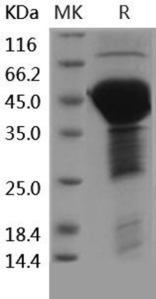 Human MAPT/Tau Recombinant Protein (His Tag) (RPES2554)