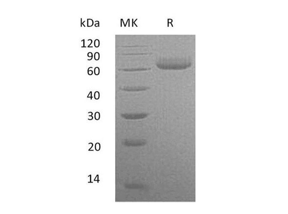 Human VNN2 Recombinant Protein (RPES2569)