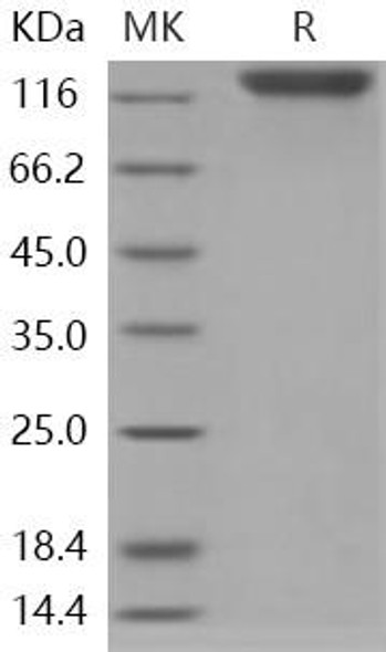 Human OSMR/IL31RB Recombinant Protein (aa 1-740, His Tag) (RPES2595)