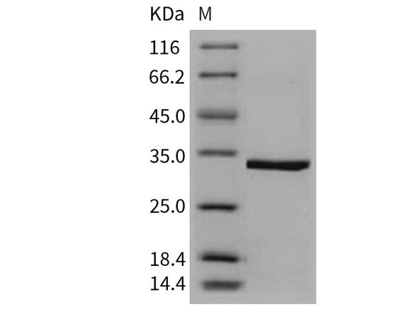 Human CA5A/CA-VA Recombinant Protein (RPES2596)