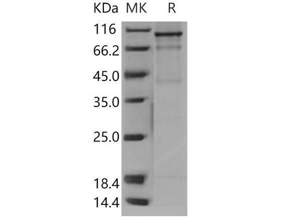Human FES Kinase/Feline sarcoma oncogene Recombinant Protein (His & GST Tag) (Active) (RPES2600)