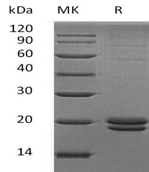 Human VMO1 Recombinant Protein (RPES2606)