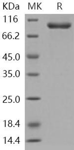 Human AGO1/Argonaute 1/EIF2C1 Recombinant Protein (His Tag) (RPES2615)