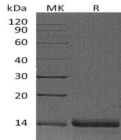 Human Profilin-2/PFN2 Recombinant Protein (RPES2709)