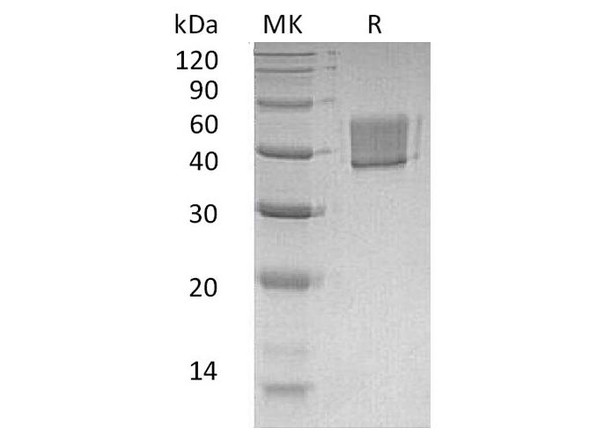 Human FCRL1 Recombinant Protein (RPES2774)