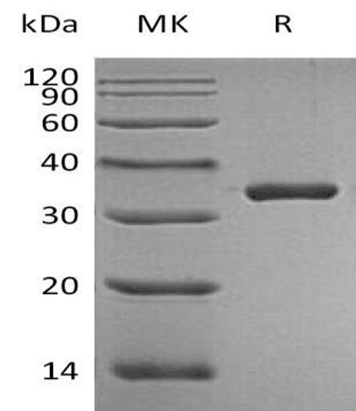 Human PSA/KLK3 Recombinant Protein (RPES2950)