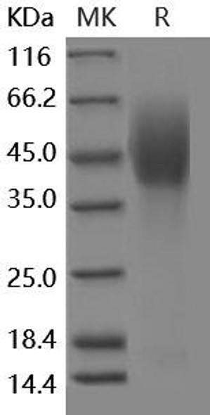 Human NPC1 Recombinant Protein (His & FLAG Tag) (RPES2958)