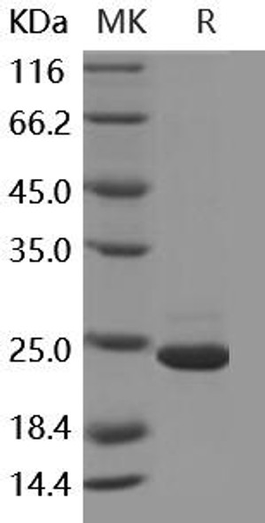 Human GKN1/Gastrokine 1 Recombinant Protein (His Tag) (RPES3136)