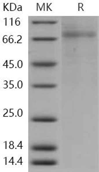 Human PLTP Recombinant Protein (His Tag) (RPES3175)