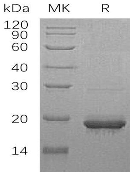 Human SCO1/SCOD1 Recombinant Protein (RPES3346)