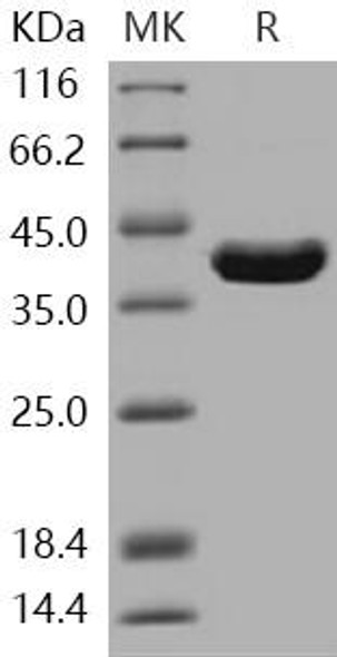 Human ITCH/AIP4 Recombinant Protein (aa 526-903) (RPES3476)