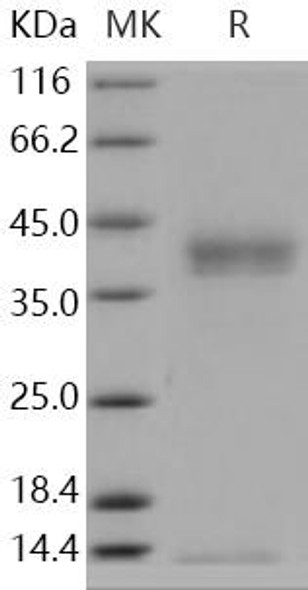 Pancreasin/Marapsin/PRSS27 Recombinant Protein (RPES3579)