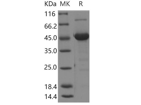 Human MANF/ARMET Recombinant Protein (Fc Tag) (RPES3707)