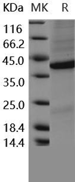Human FRZB/sFRP-3 Recombinant Protein (His Tag) (RPES3816)
