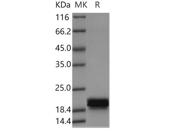 Human CNPY2 Recombinant Protein (His Tag) (RPES4101)