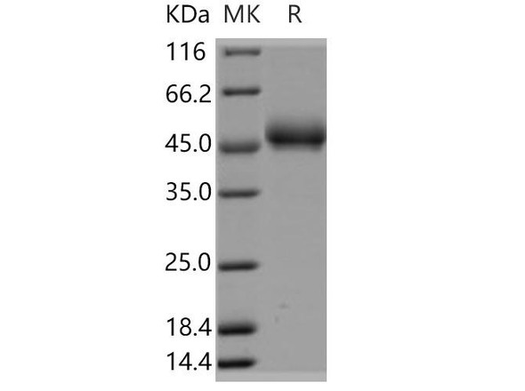 Human FAM171B/KIAA1946 Recombinant Protein (RPES4148)