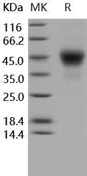 Human TROP2/TACSTD2 Recombinant Protein (RPES4204)