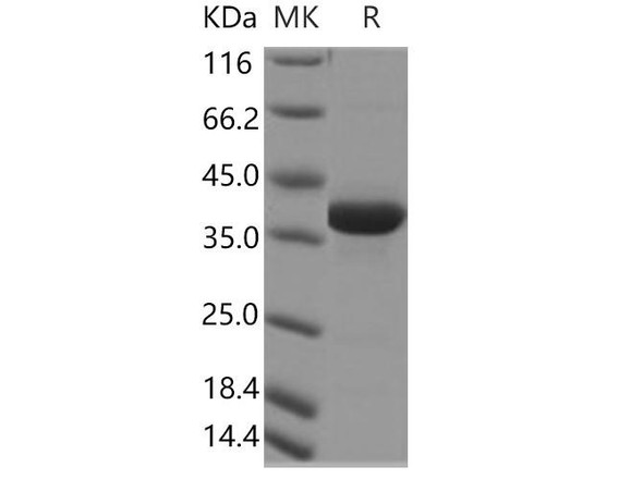 Human CART/CARTPT Recombinant Protein (Fc Tag) (RPES4227)