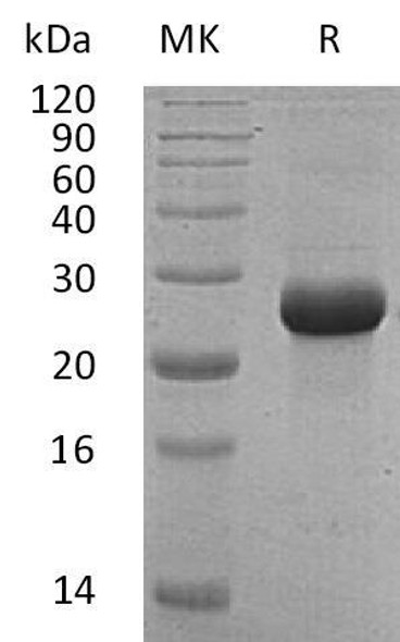 Human FSTL1 Recombinant Protein (RPES4279)