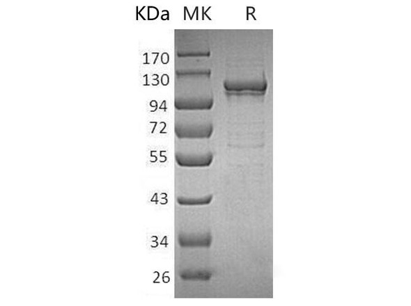 Human MANSC1 Recombinant Protein (RPES4304)