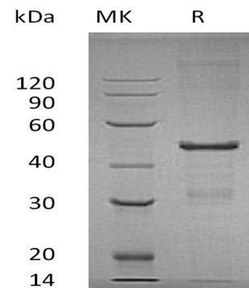 Human MBIP Recombinant Protein (RPES4329)