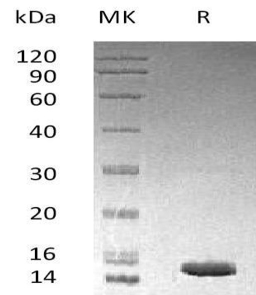 Human LAMTOR3/MP1 Recombinant Protein (RPES4401)