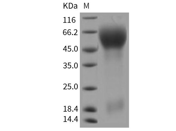 Rat CD133/PROM1/Prominin 1 Recombinant Protein (His Tag) (RPES4417)
