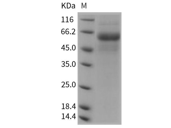 Rat DDR2 Kinase/CD167b Recombinant Protein (His Tag) (RPES4533)
