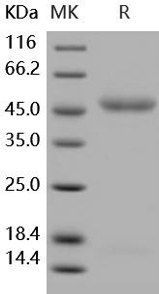 Human IL11RA/IL11Ralpha Recombinant Protein (His Tag) (Active) (RPES4985)