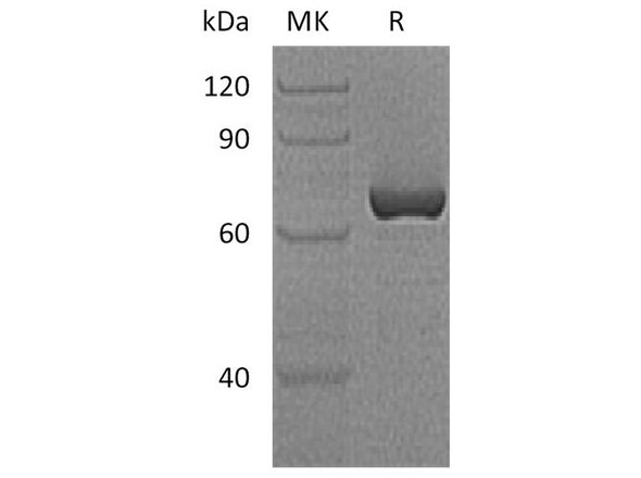 Human Vaspin/SerpinA12 Recombinant Protein (RPES5075)