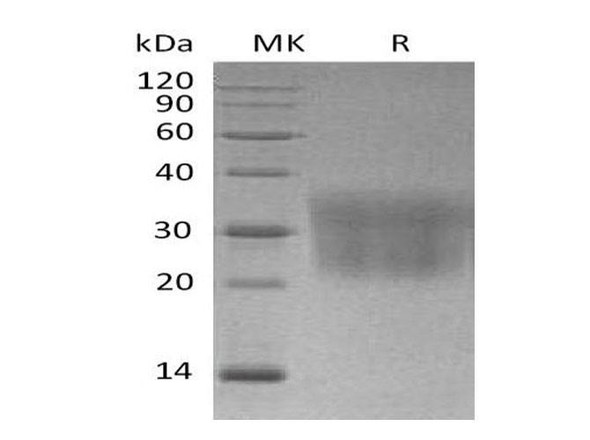 Mouse CCL2/MCP Recombinant Protein (RPES5090)