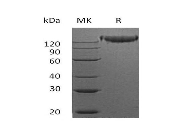 Mouse Semaphorin-4D/SEMA4D Recombinant Protein (RPES5093)