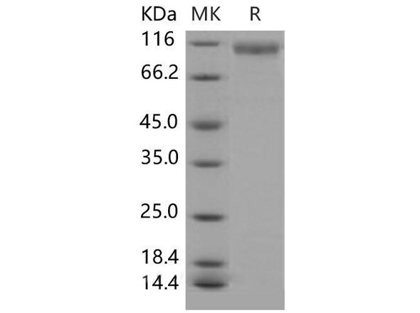 Mouse HER2/ErbB2 Recombinant Protein (His Tag) (RPES5139)