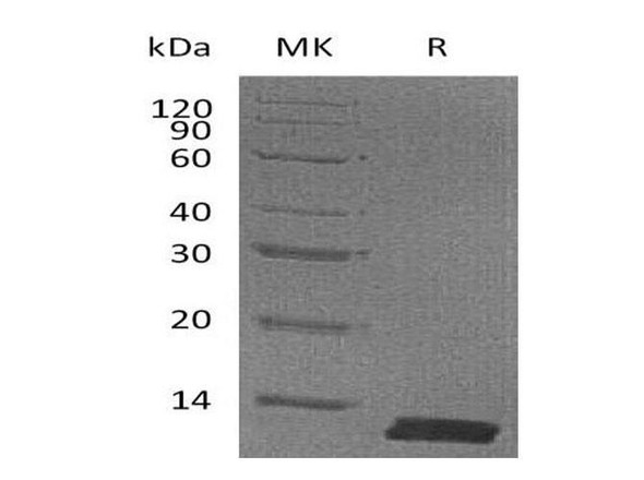 Mouse CCL8/MCP-2 Recombinant Protein (RPES5187)