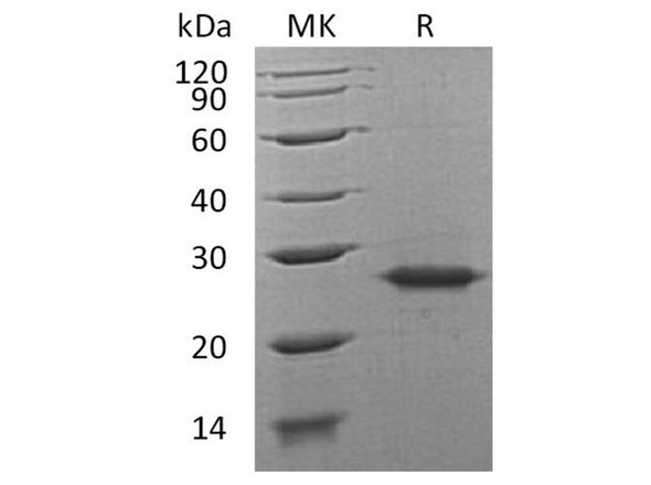 Human Grancalcin/GCA Recombinant Protein (RPES5224)
