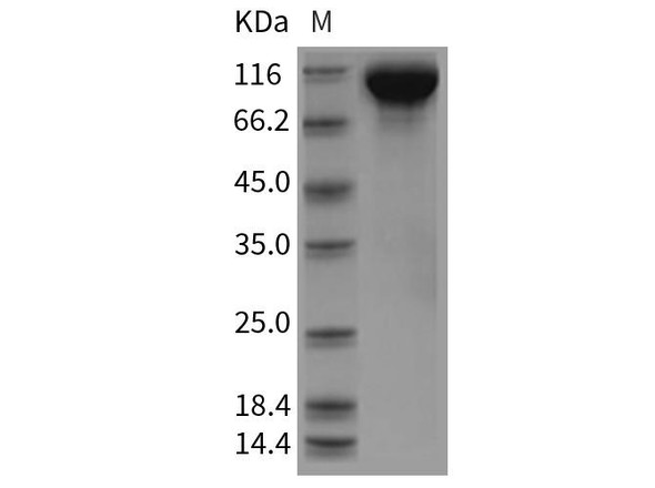 Rat EGFR/ErbB1 Recombinant Protein (His Tag) (Active) (RPES5227)