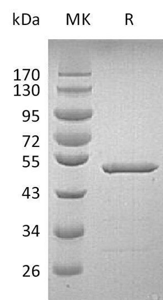 Human Grancalcin/GCA Recombinant Protein (RPES5246)