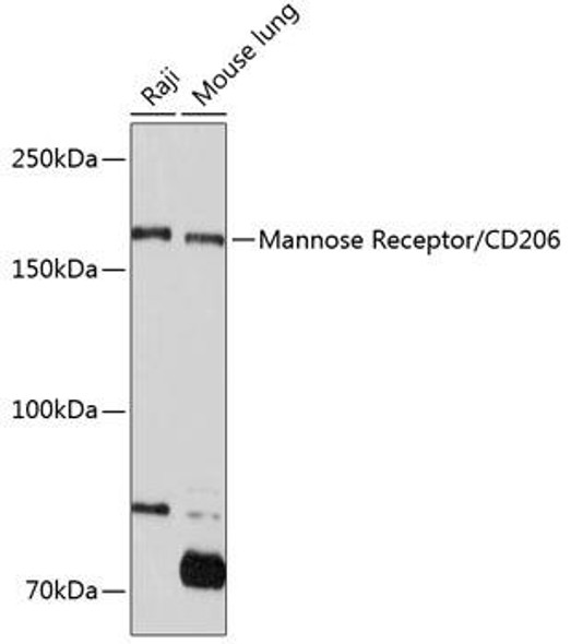 Mannose Receptor/CD206 Rabbit Monoclonal Antibody (CAB11192)