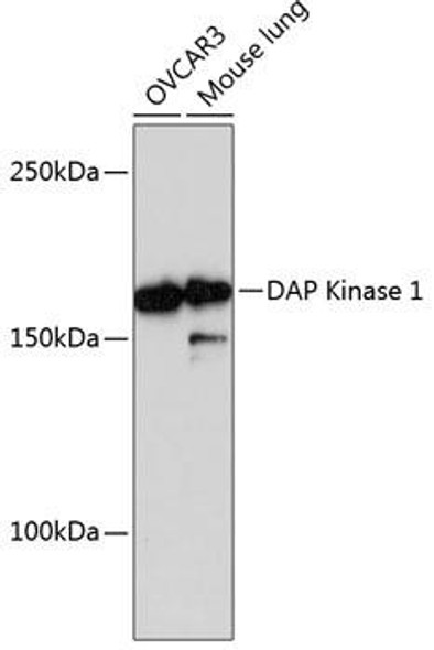 DAP Kinase 1 (DAPK1) Rabbit Monoclonal Antibody (CAB11459)