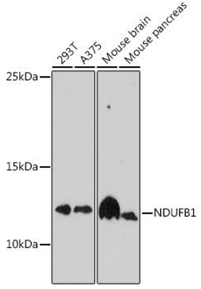 NDUFB1 Rabbit Polyclonal Antibody (CAB16925)