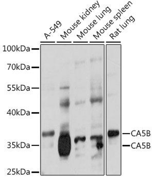 CA5B Rabbit Polyclonal Antibody (CAB17633)