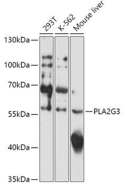 PLA2G3 Rabbit Polyclonal Antibody (CAB17696)